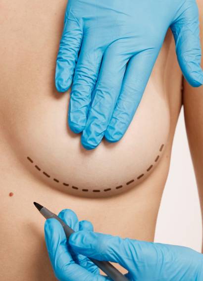 woman-marked-out-cosmetic-surgery-2048x1365